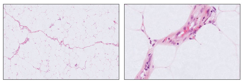 Septa and the nuclei along with septa.