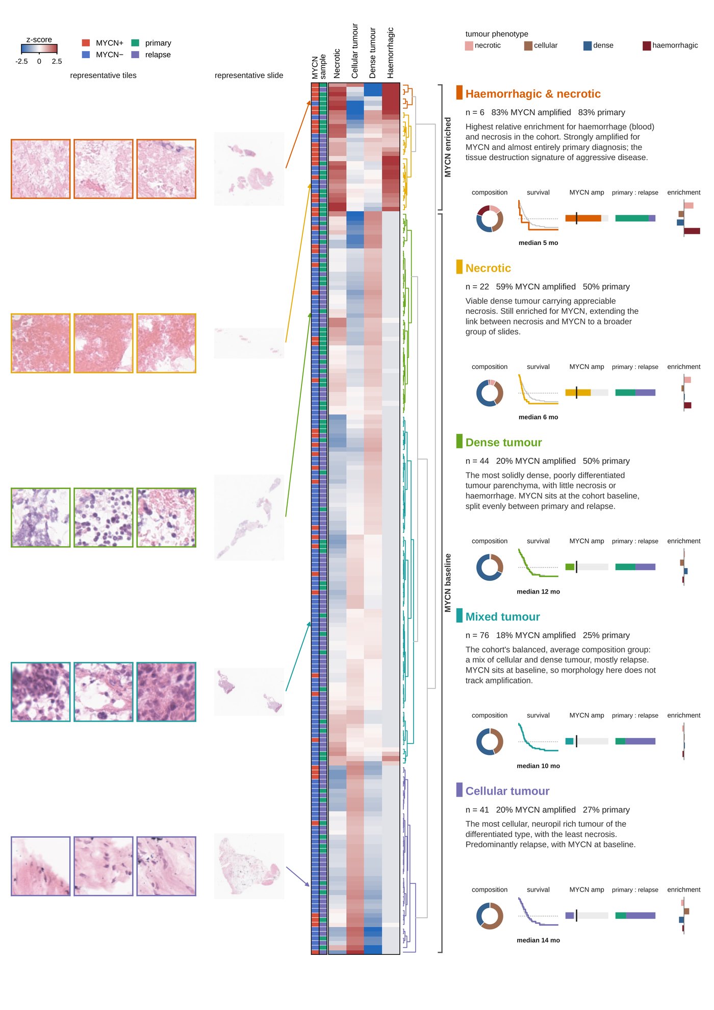 Five model-derived neuroblastoma phenotypes with representative tiles, whole-slide thumbnails, a clustered heat map, and per-phenotype composition, survival and enrichment summaries.